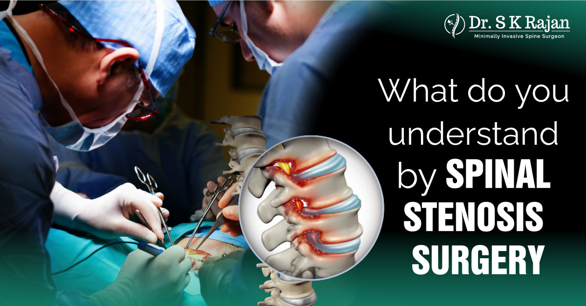 dr sk rajan spinal stenosis