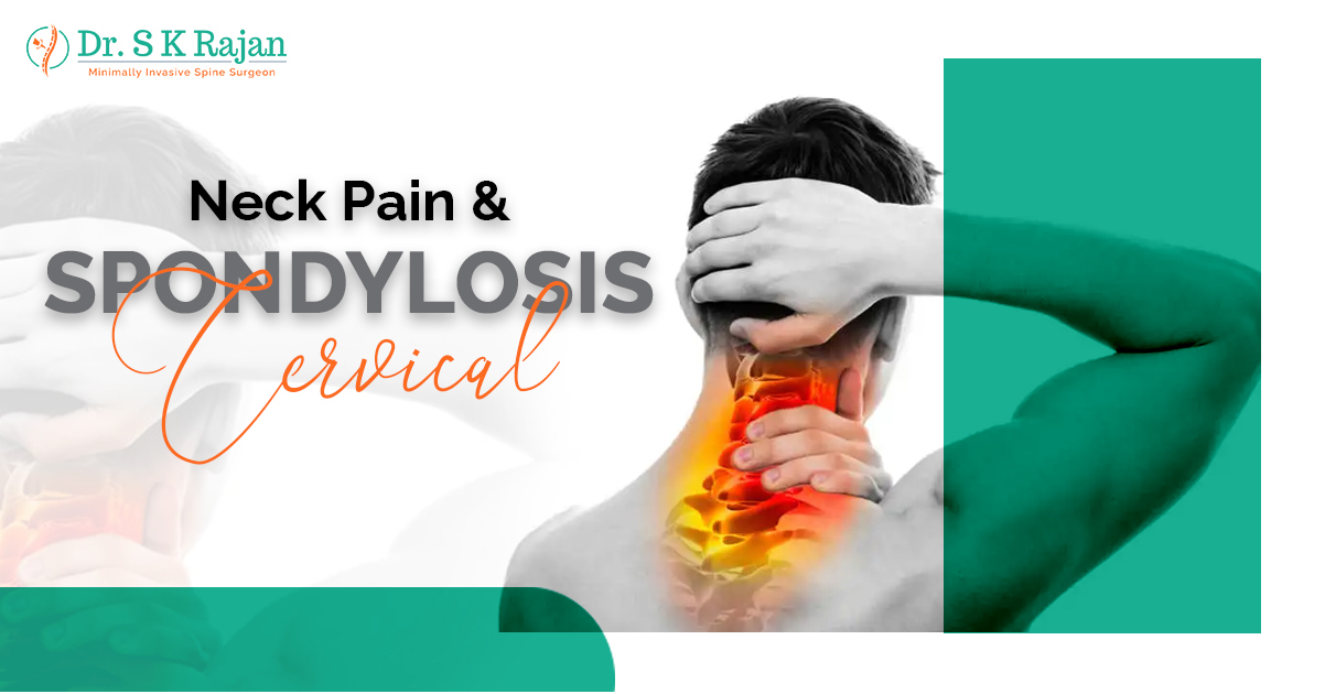 Neck Pain And Cervical Spondylosis