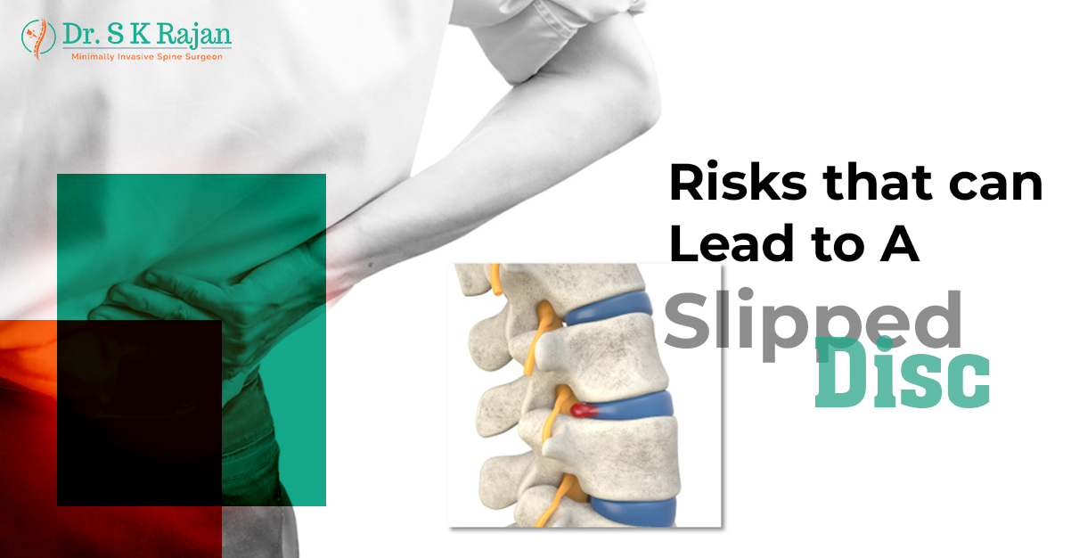 Risks That Can Lead To A Slipped Disc
