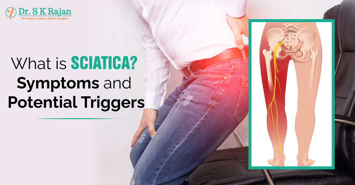 Sciatica Symptoms and potential triggers