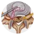 Endoscopic Removal of Spinal Tumors